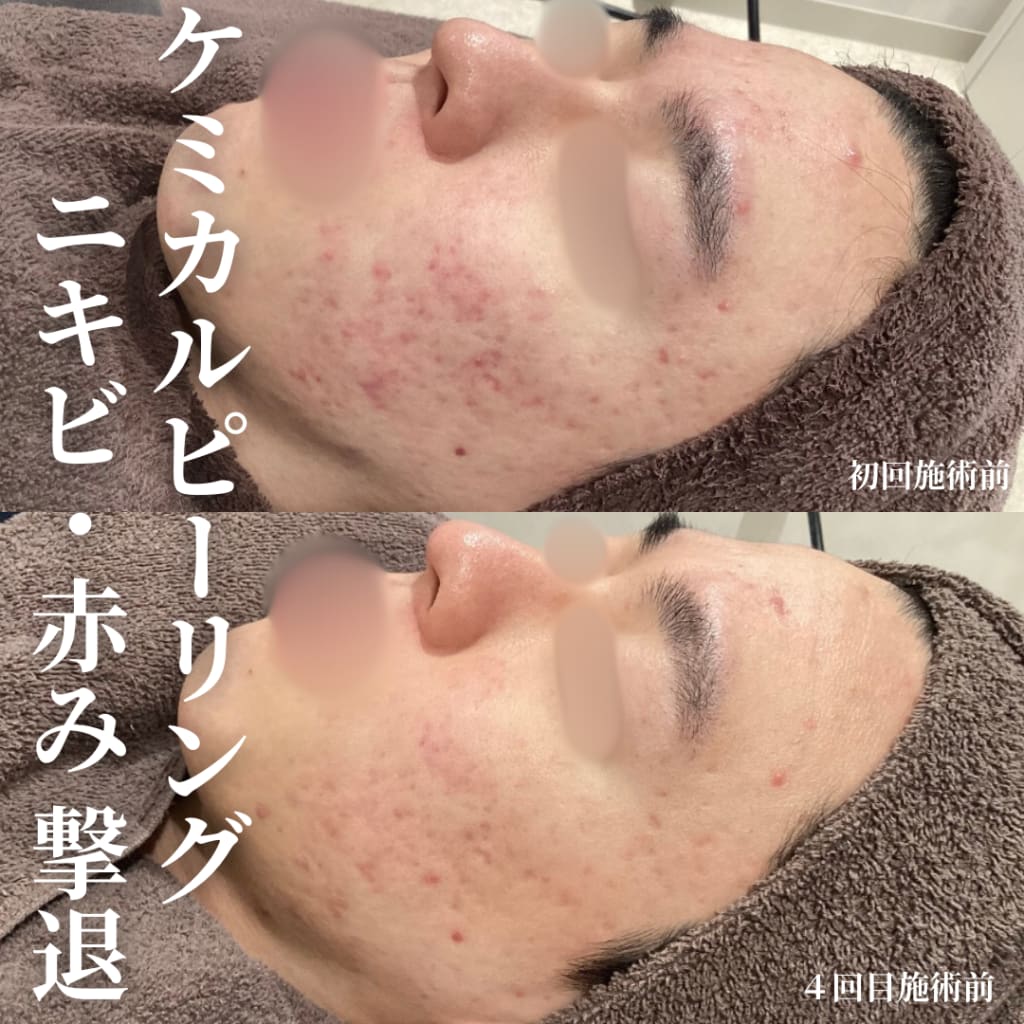 症例のビフォー画像