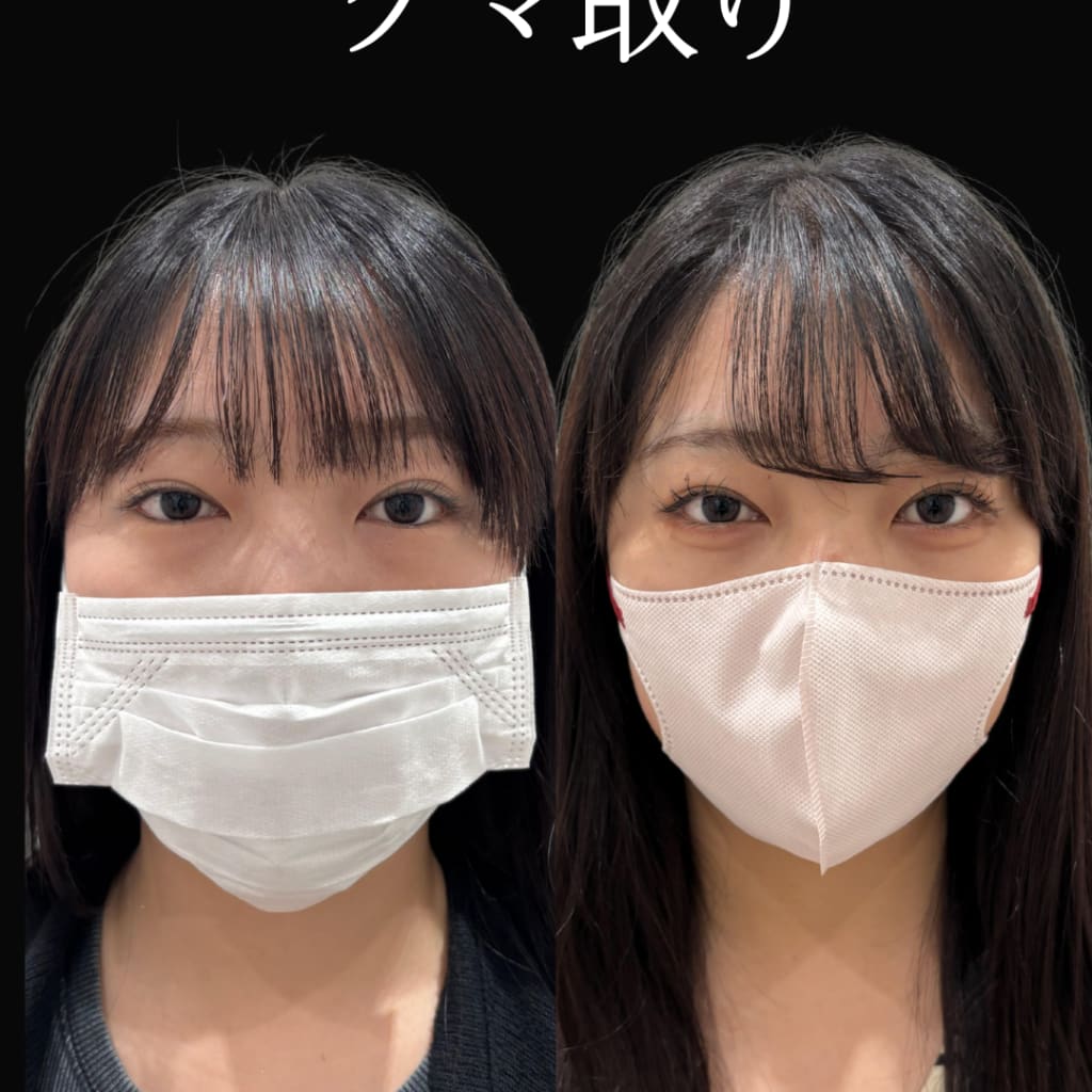 症例のビフォー画像