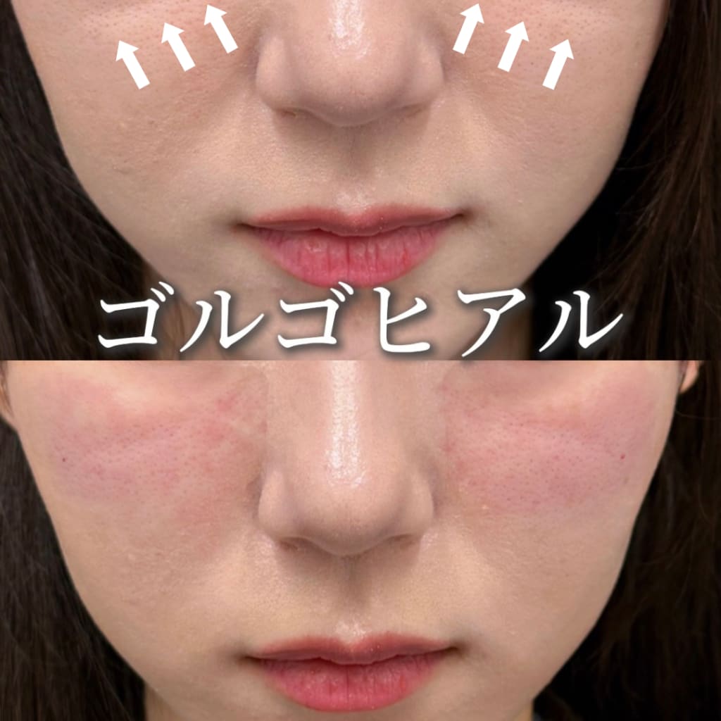 症例のビフォー画像