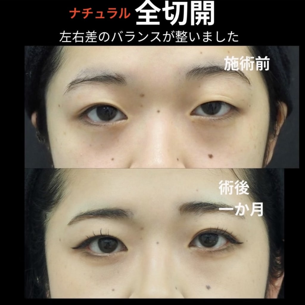 症例のビフォー画像