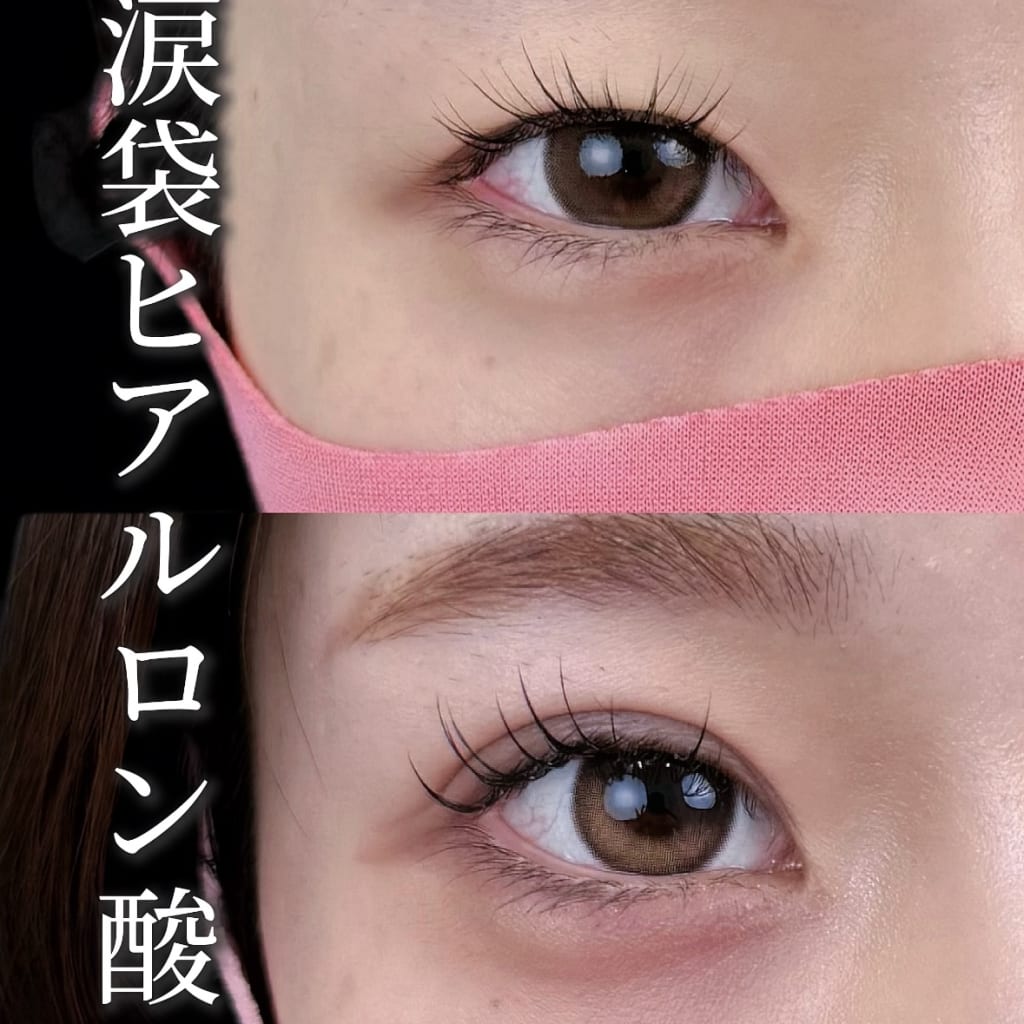 症例のビフォー画像