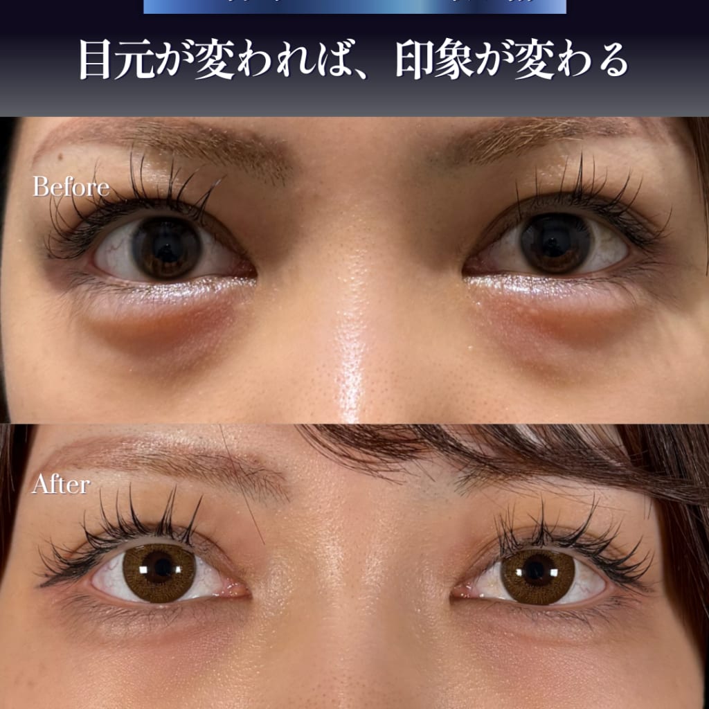 症例のビフォー画像