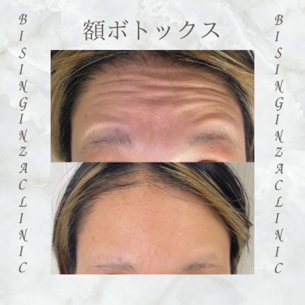症例のビフォー画像