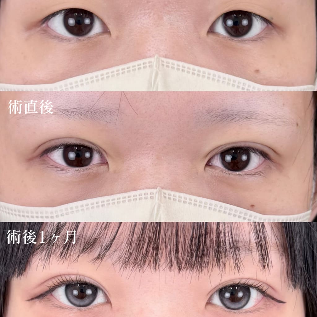 症例のビフォー画像