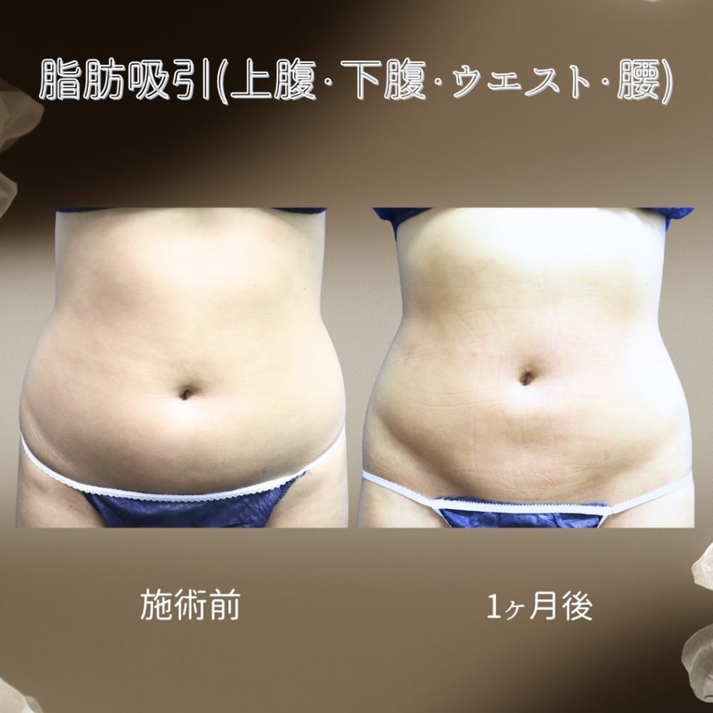 症例のビフォー画像