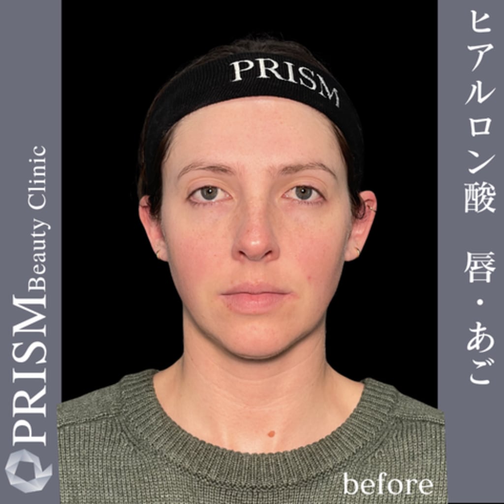 症例のビフォー画像