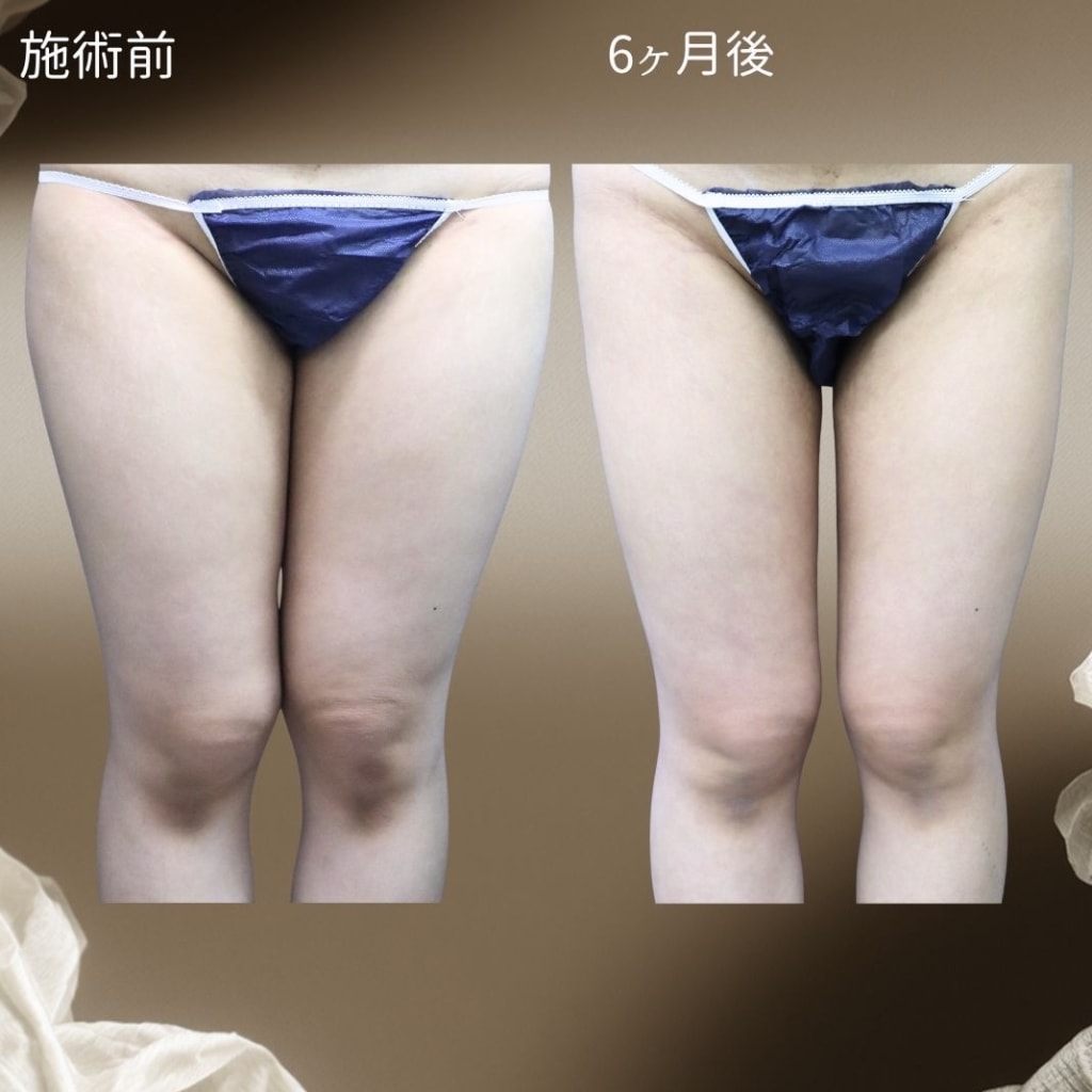 症例のビフォー画像