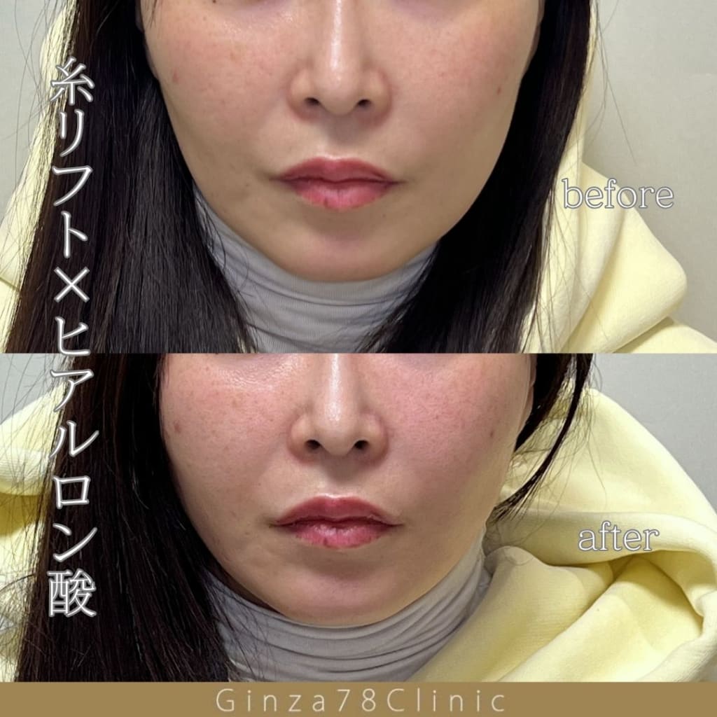 症例のビフォー画像