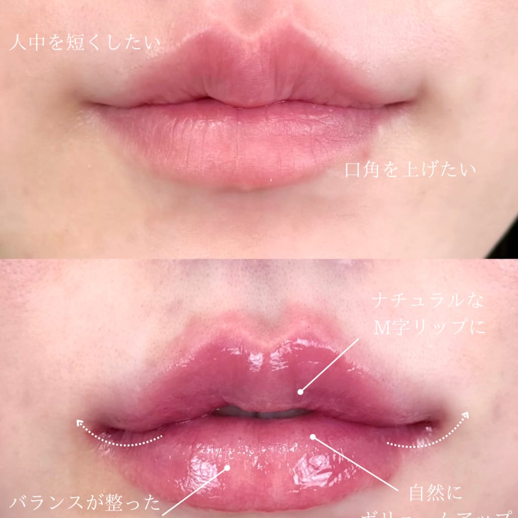 症例のビフォー画像