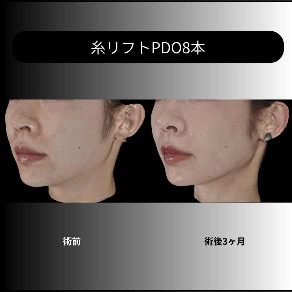 症例のビフォー画像