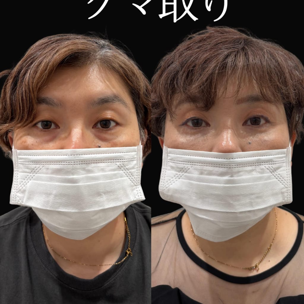 症例のビフォー画像