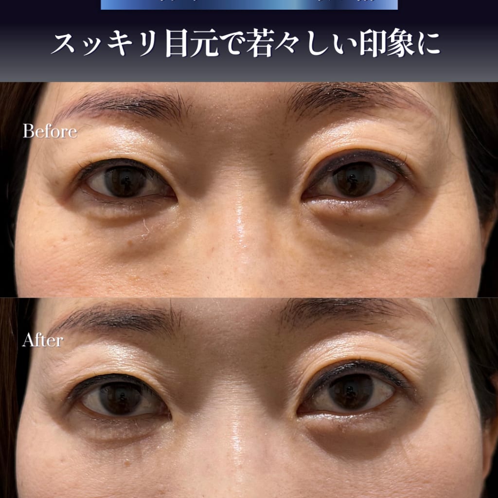 症例のビフォー画像