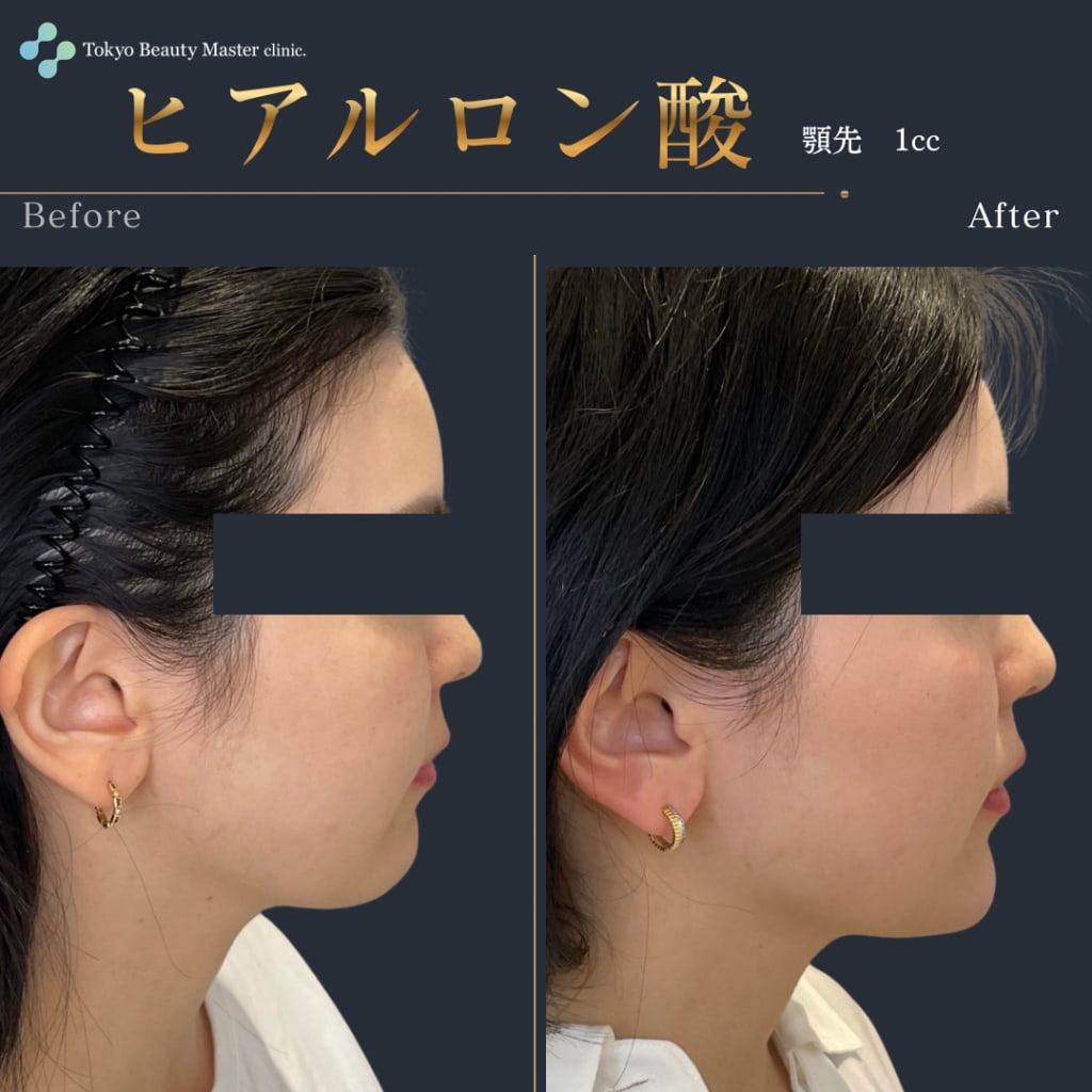 症例のビフォー画像