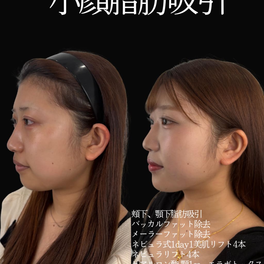 症例のビフォー画像