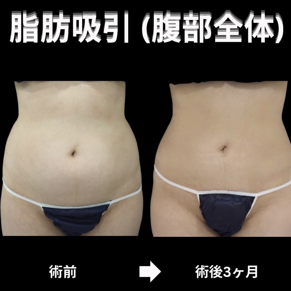 症例のビフォー画像