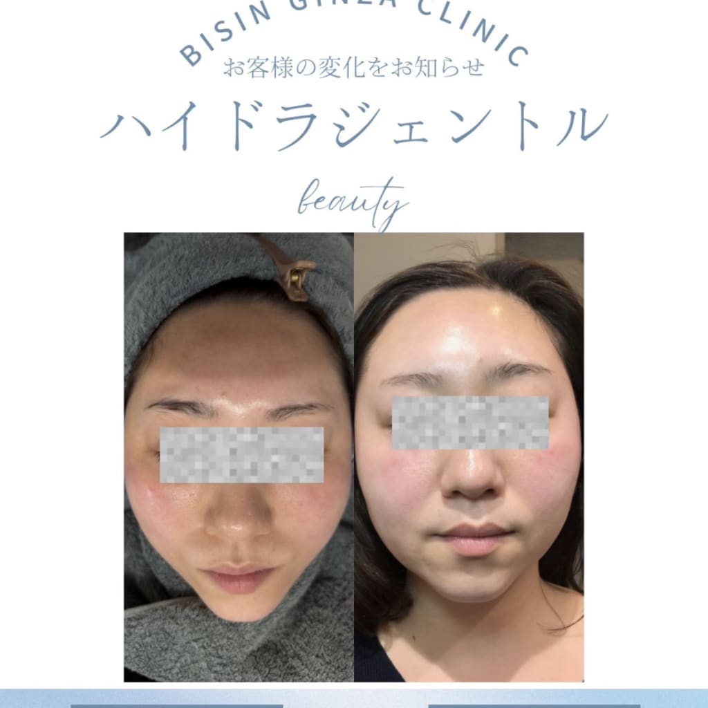症例のビフォー画像