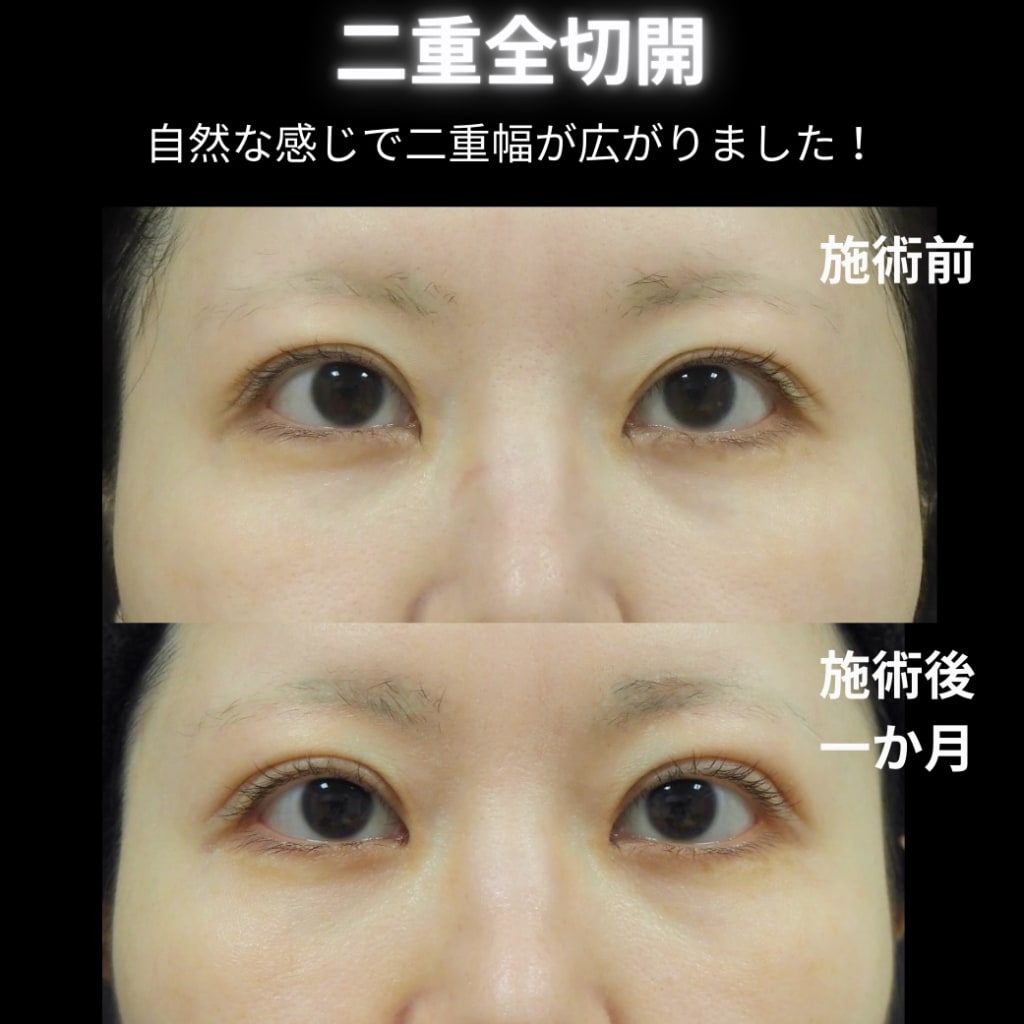 症例のビフォー画像
