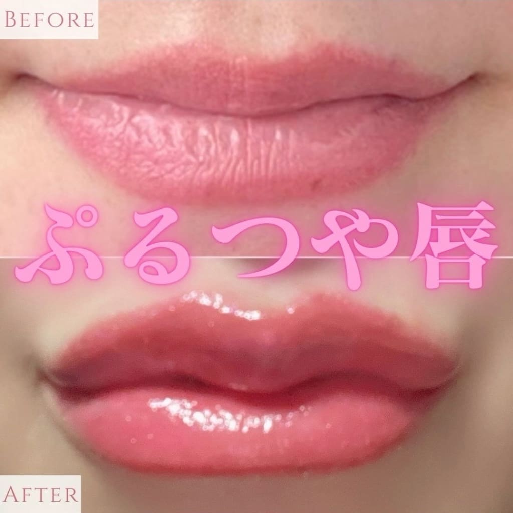 症例のビフォー画像