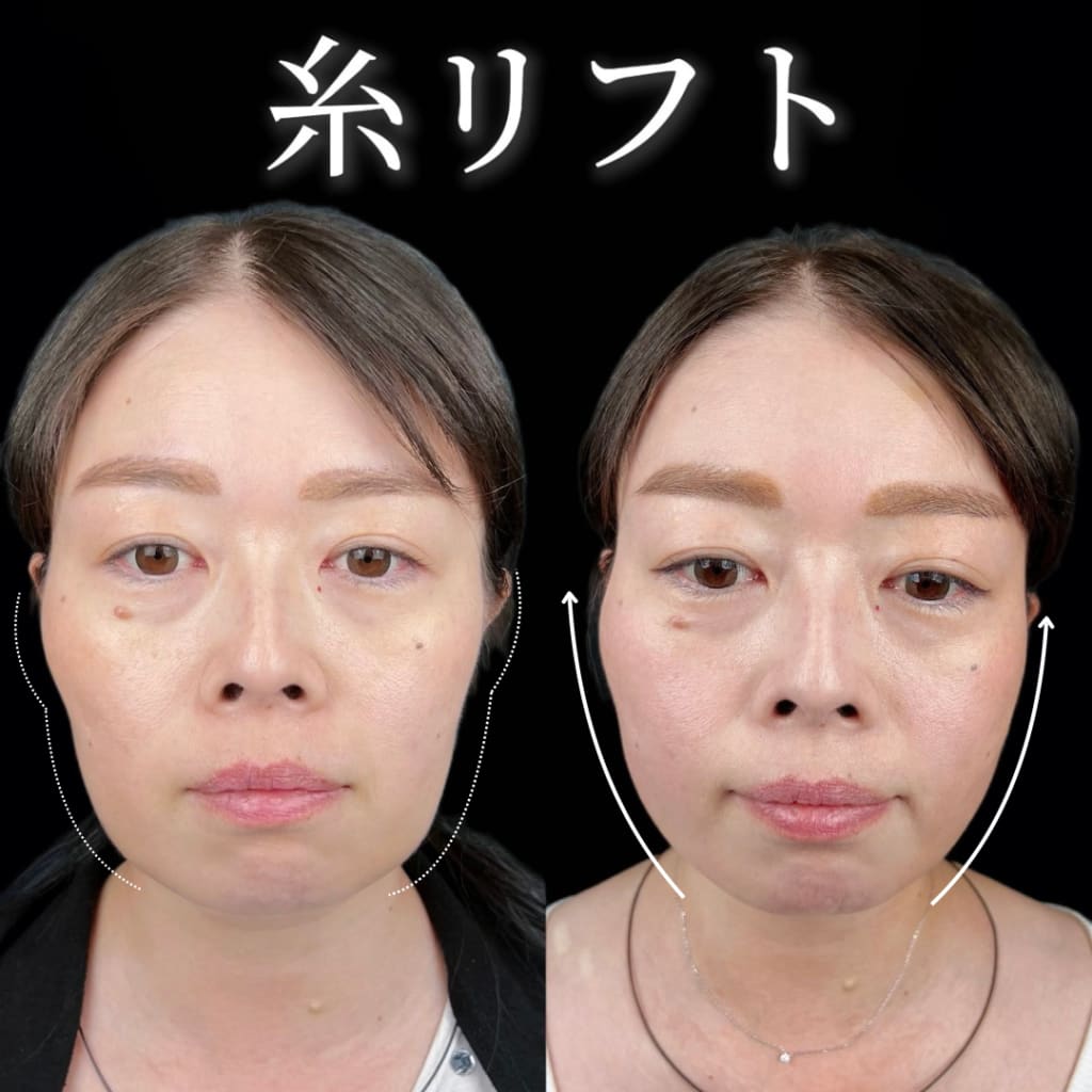 症例のビフォー画像