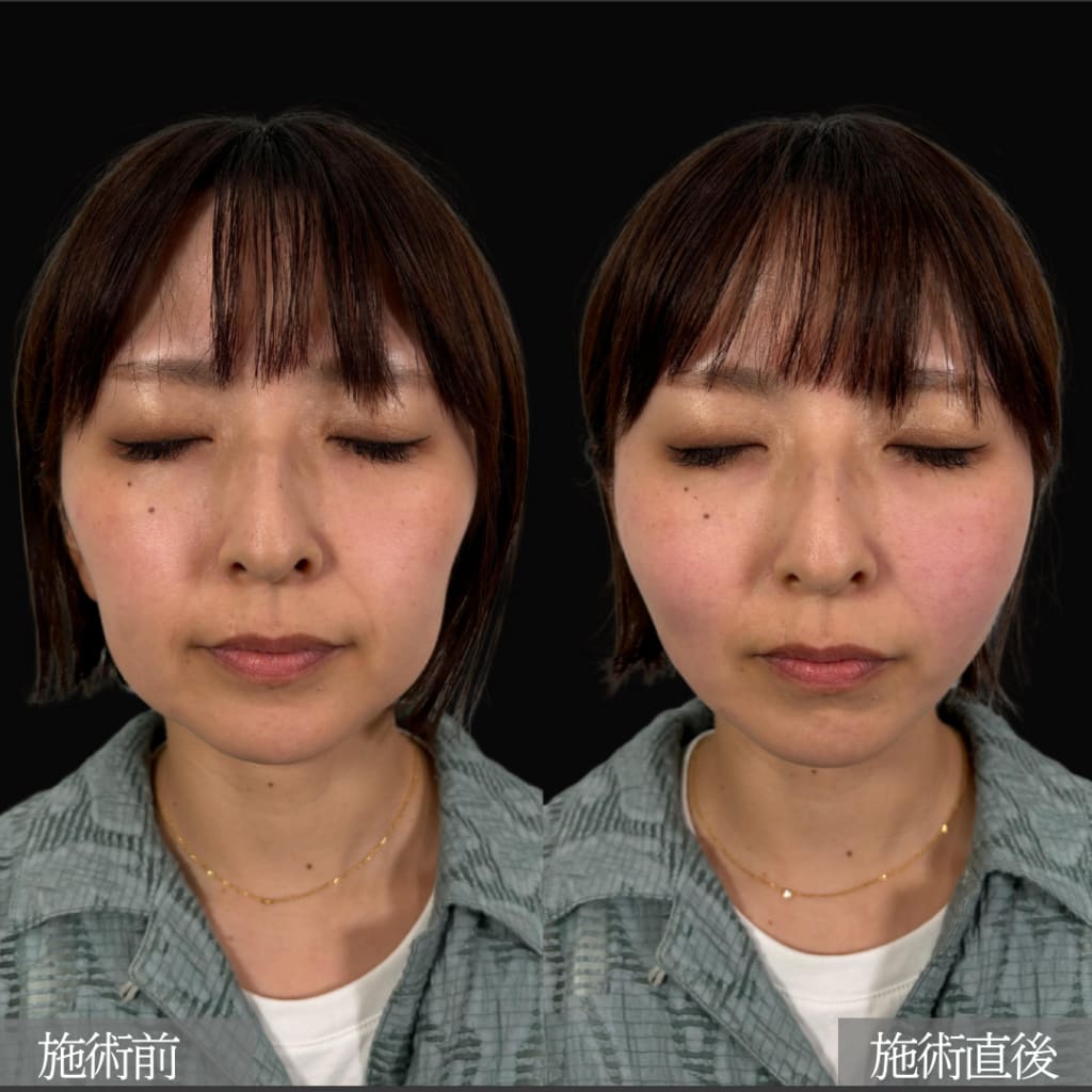 症例のビフォー画像