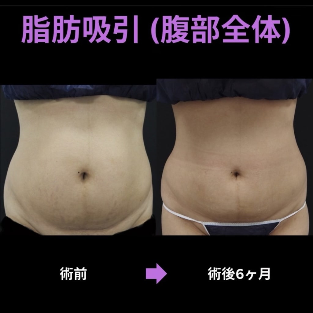症例のビフォー画像