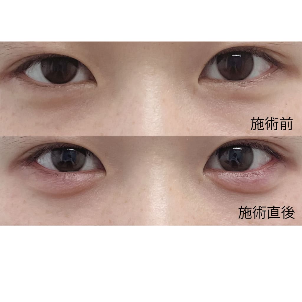症例のビフォー画像