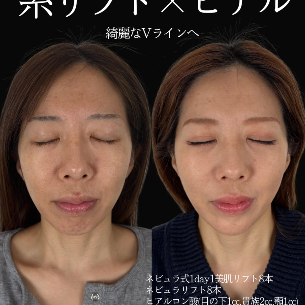 症例のビフォー画像