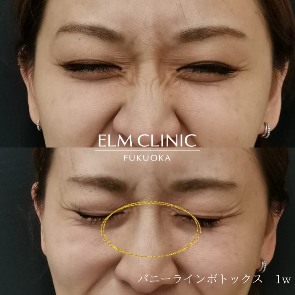 症例のビフォー画像
