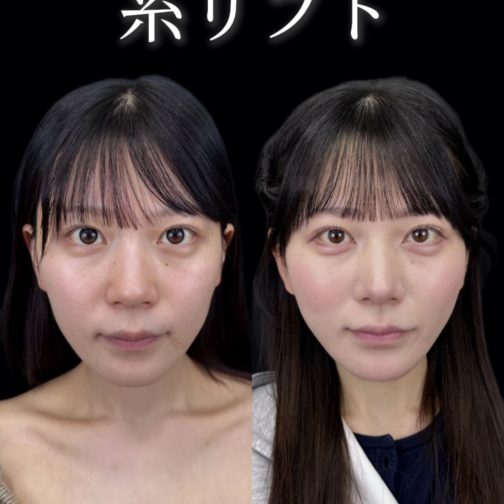 症例のビフォー画像