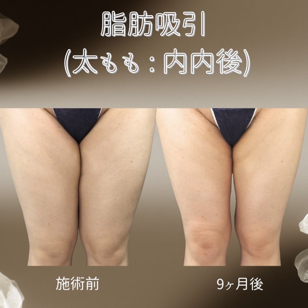 症例のビフォー画像