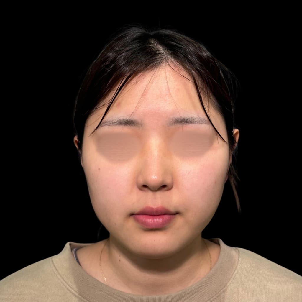 症例のビフォー画像