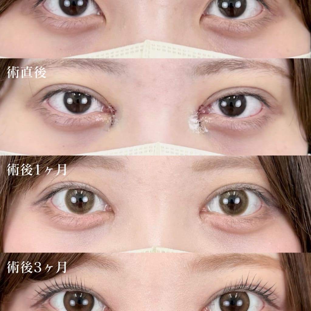 症例のビフォー画像