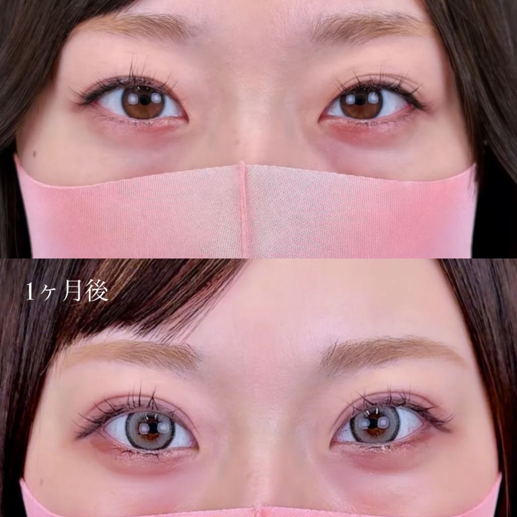 症例のビフォー画像
