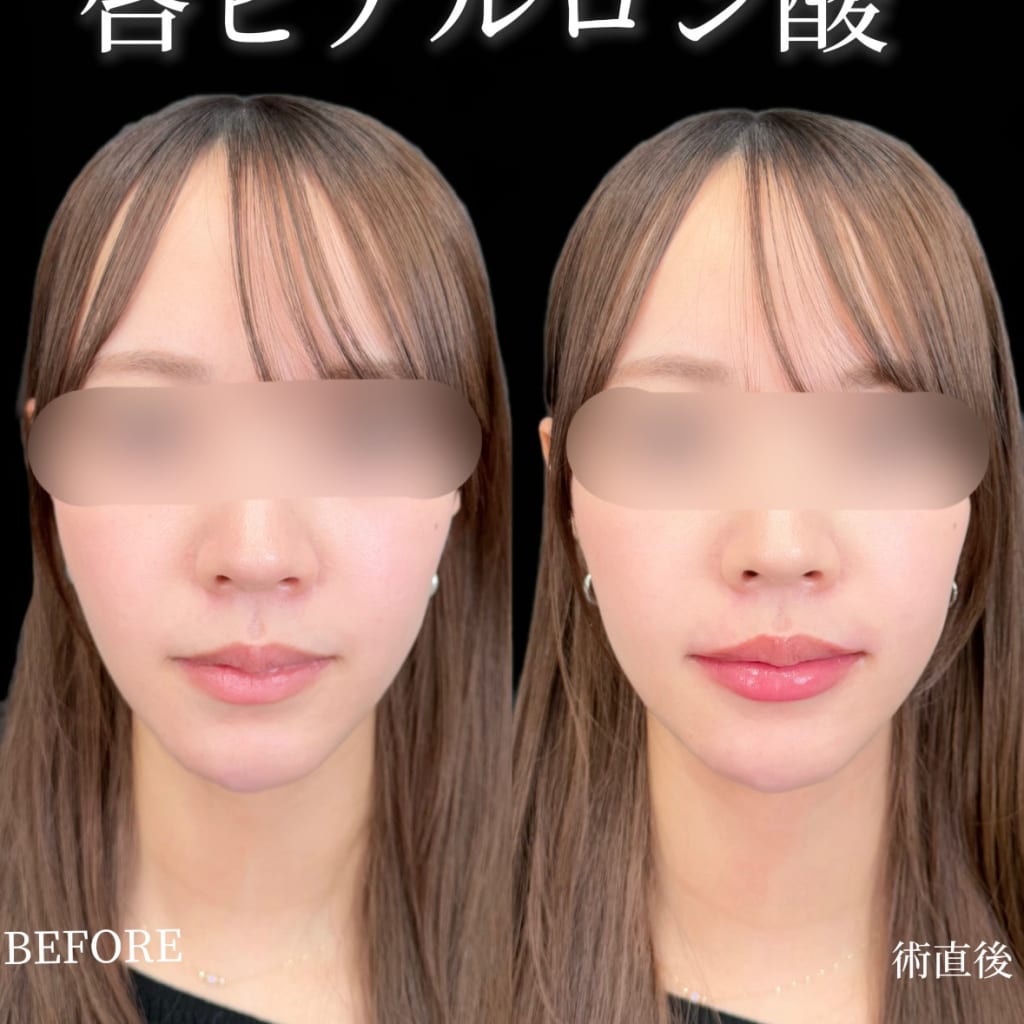 症例のビフォー画像