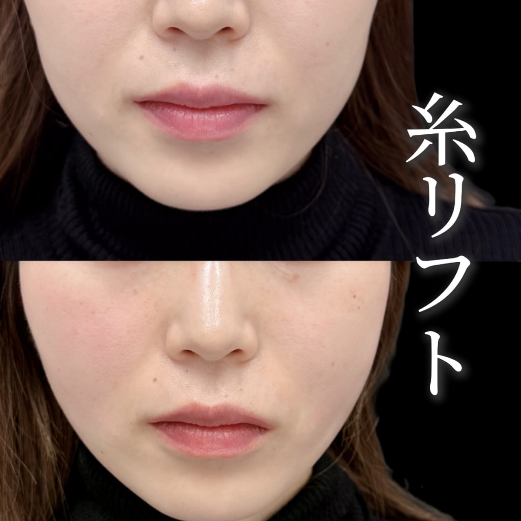 症例のビフォー画像