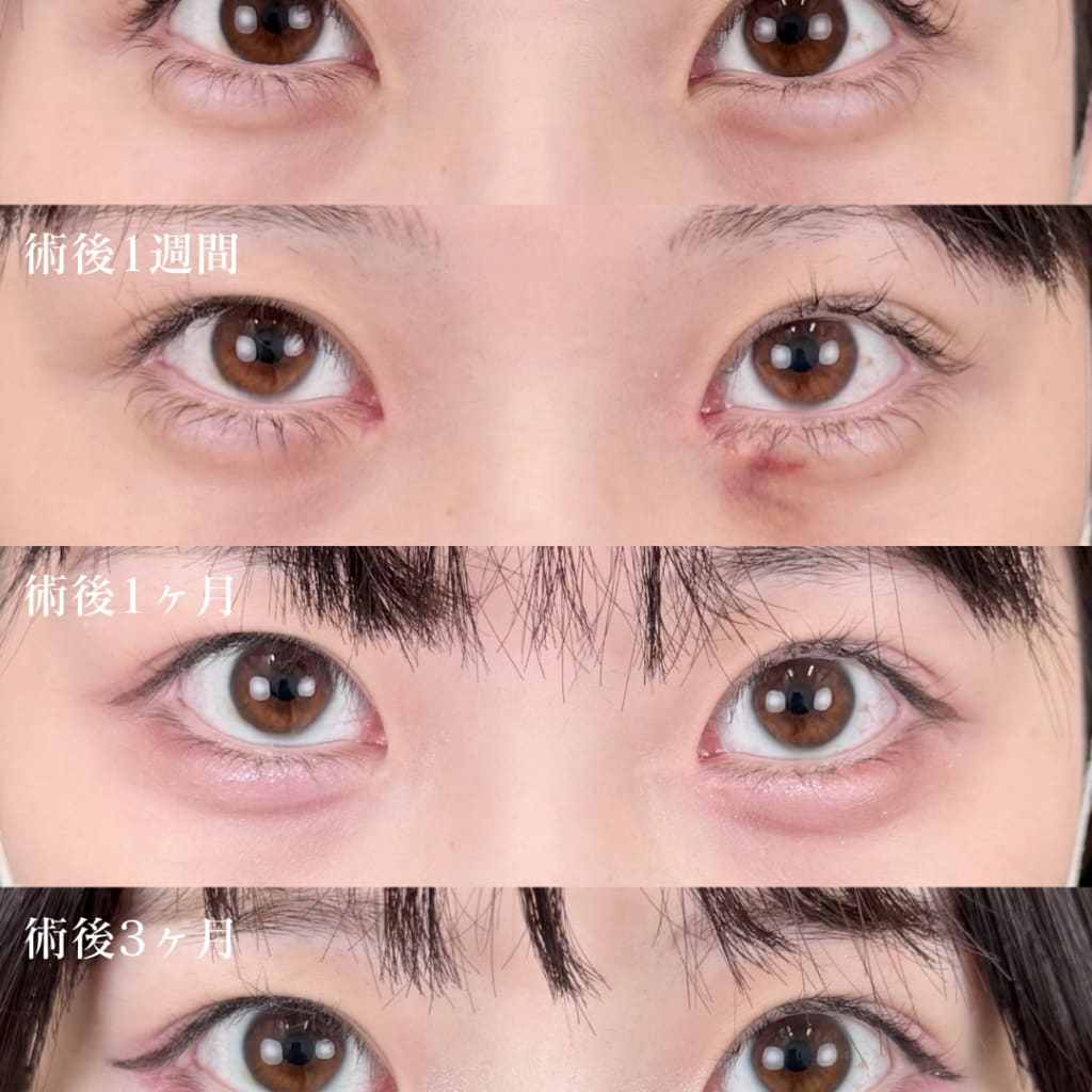 症例のビフォー画像