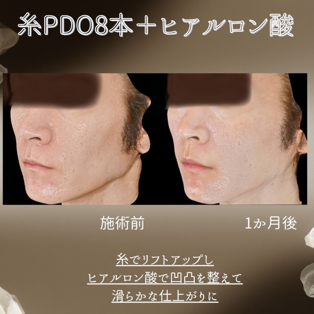 症例のビフォー画像