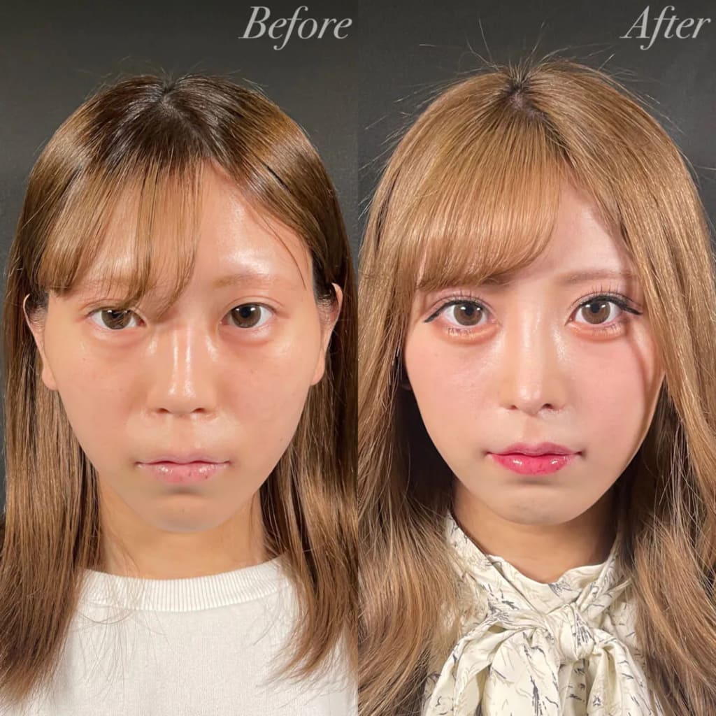 症例のビフォー画像