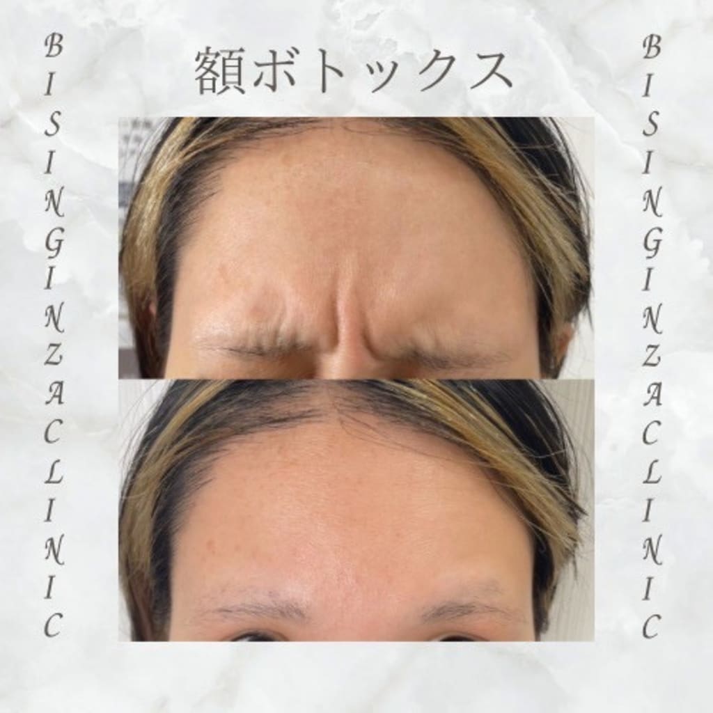 症例のビフォー画像
