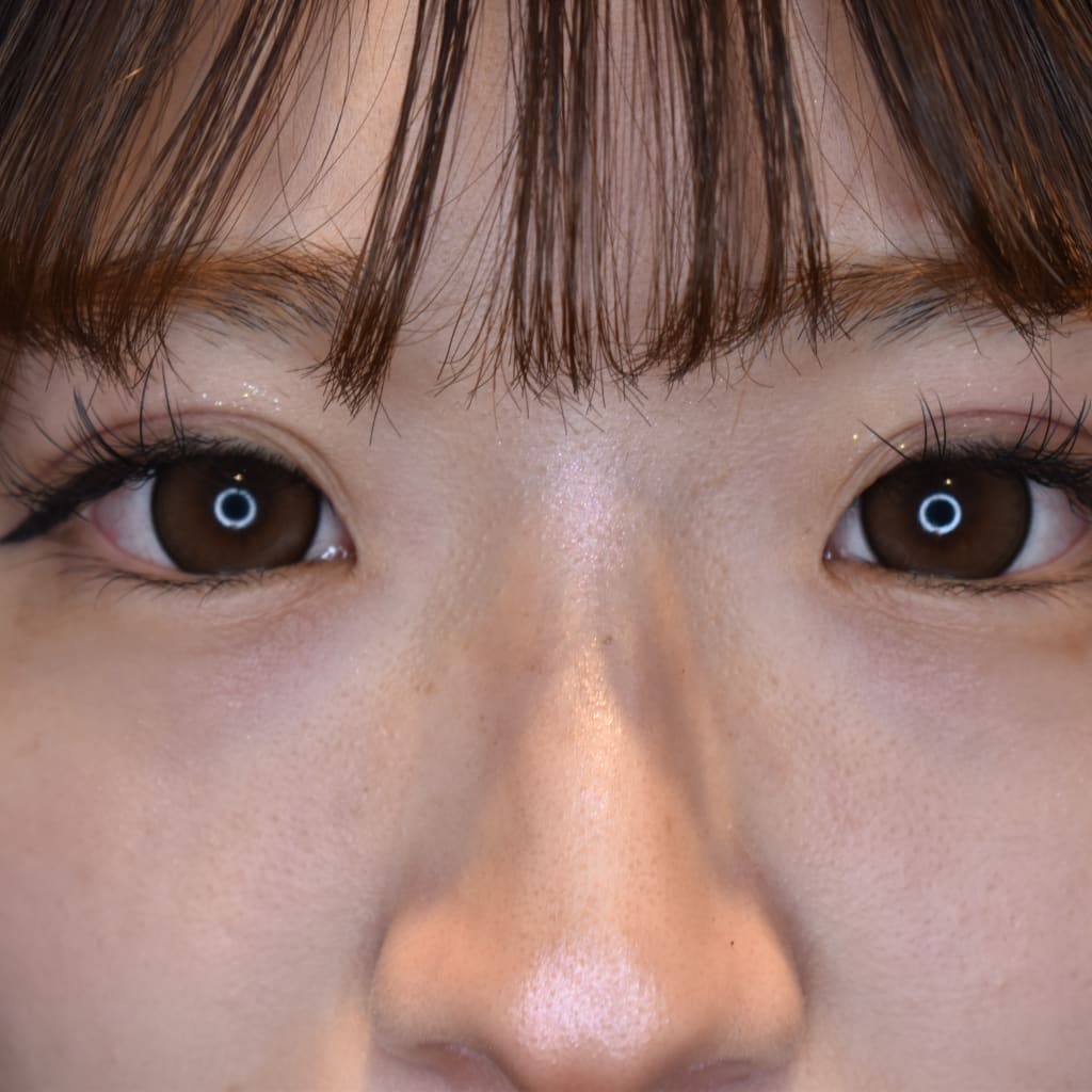 症例のビフォー画像
