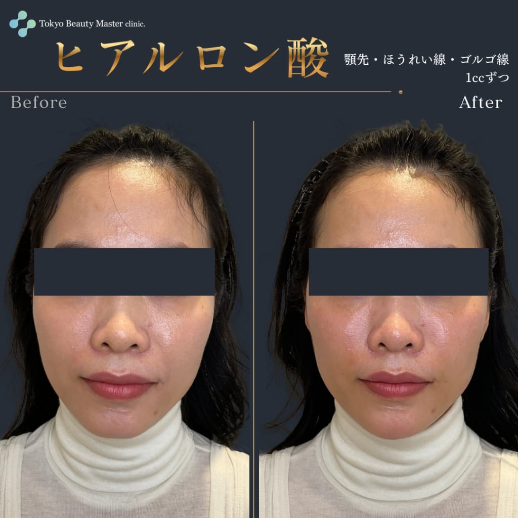 症例のビフォー画像