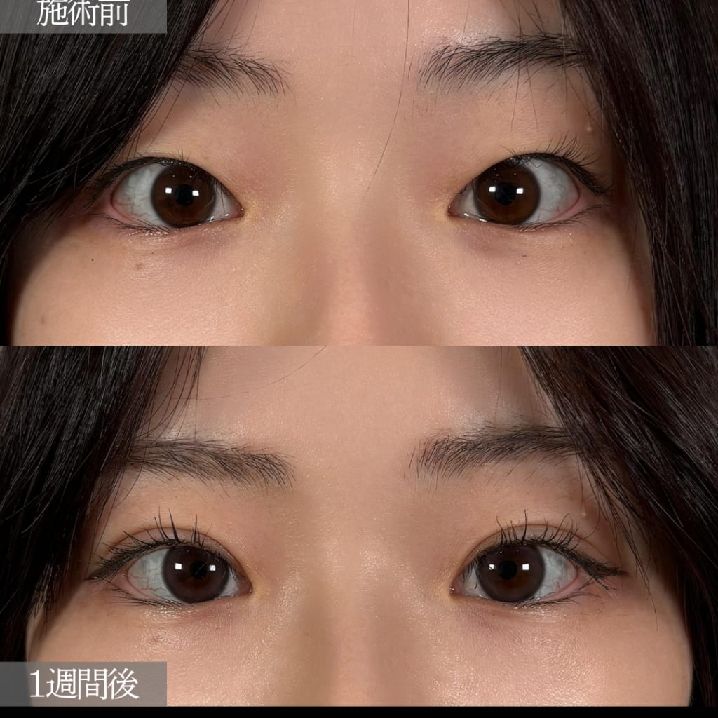 症例のビフォー画像