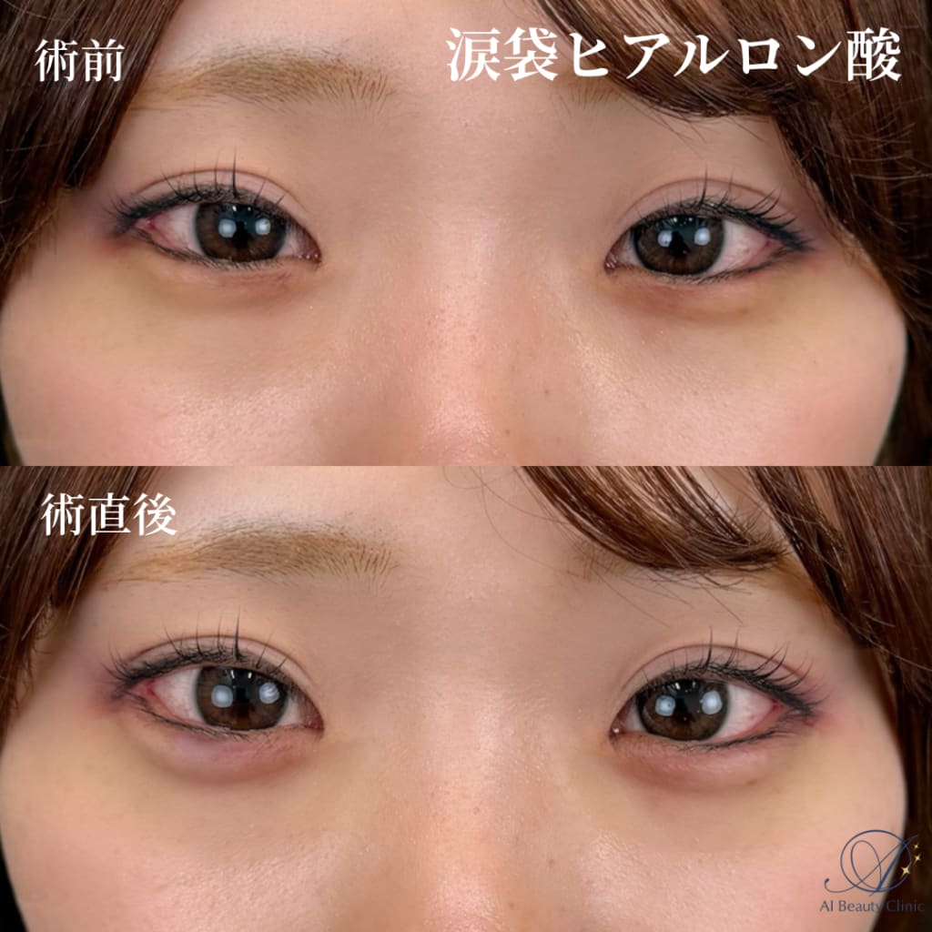 症例のビフォー画像