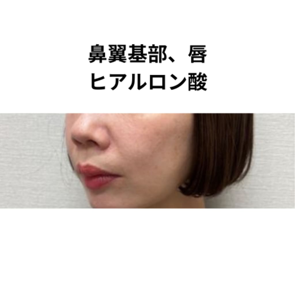症例のビフォー画像