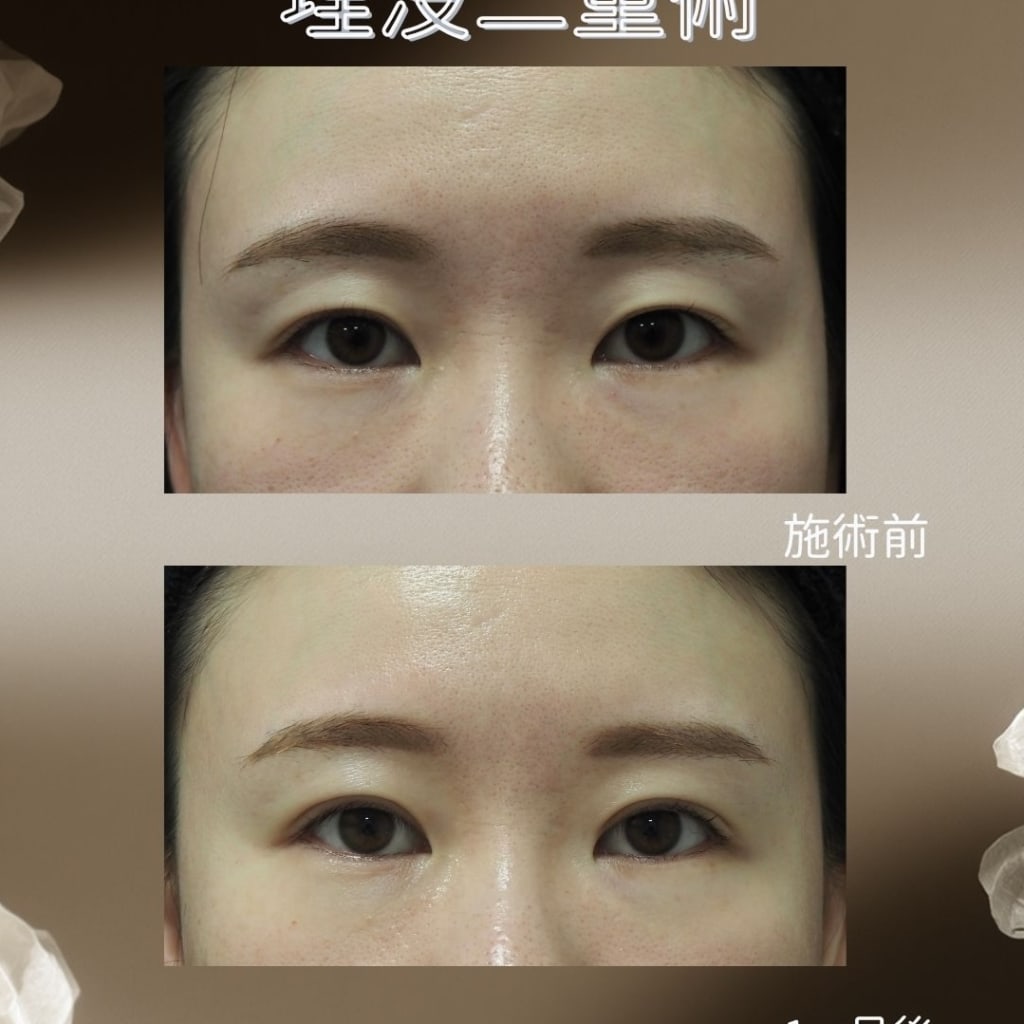 症例のビフォー画像