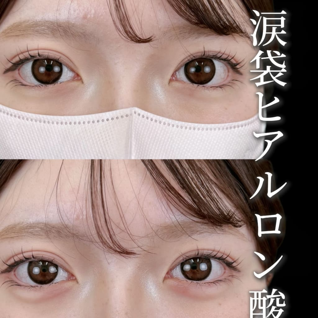 症例のビフォー画像