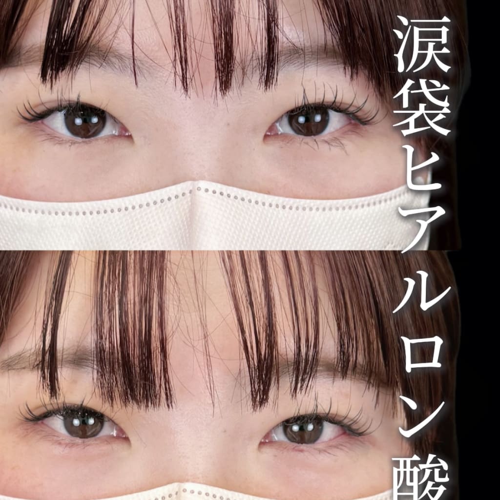 症例のビフォー画像
