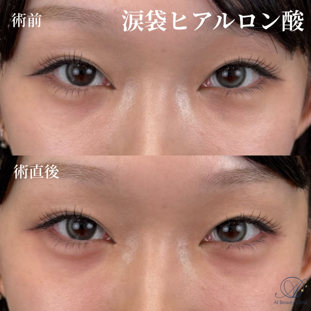 症例のビフォー画像