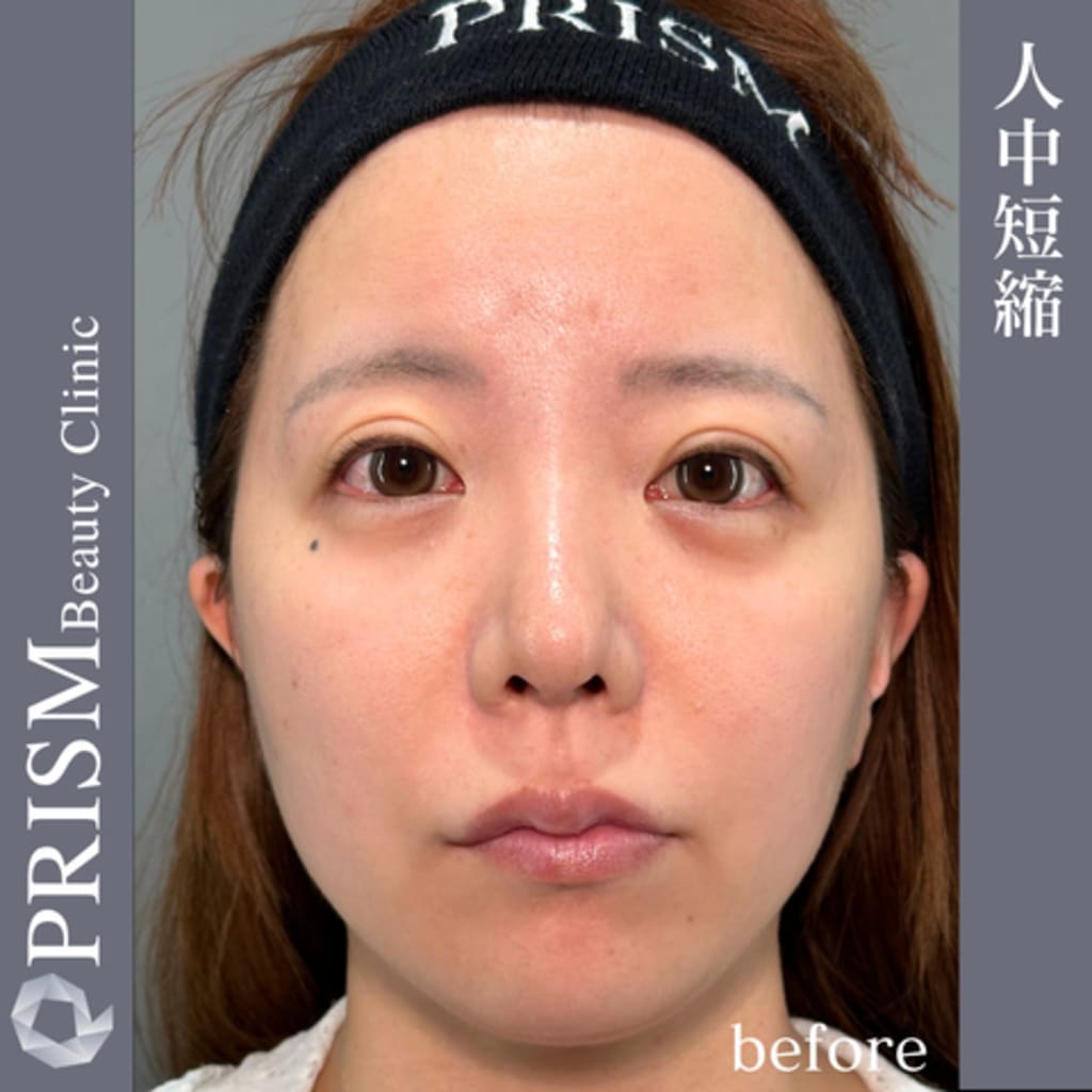 症例のビフォー画像