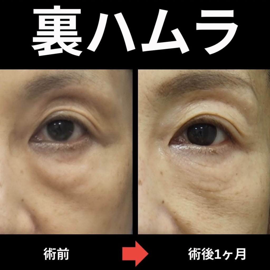 症例のビフォー画像